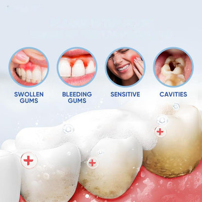 【Buy 1 Free 1】Bodyaccel Probiotic Whitening Toothpaste